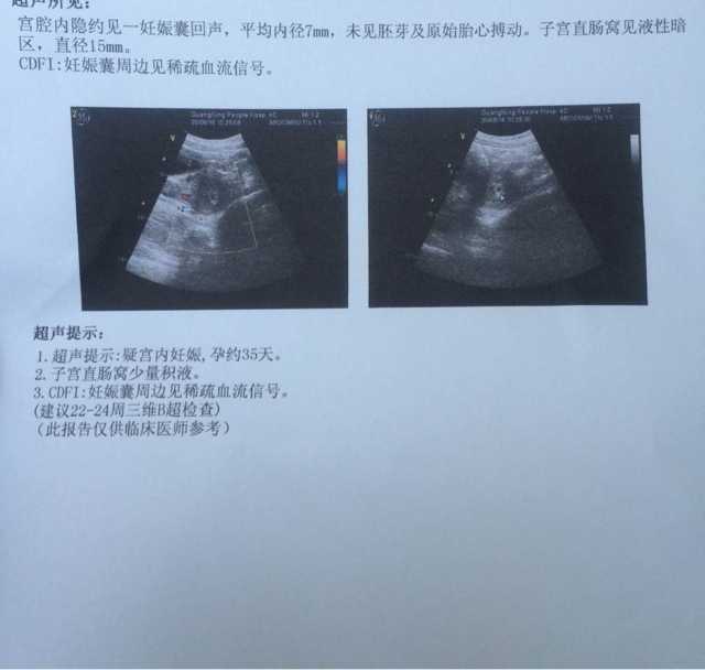私人供卵与不孕不育治疗误区解析及医院选择指南