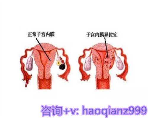 第三代人工助孕技术如何实现性别选择与科学备孕方法